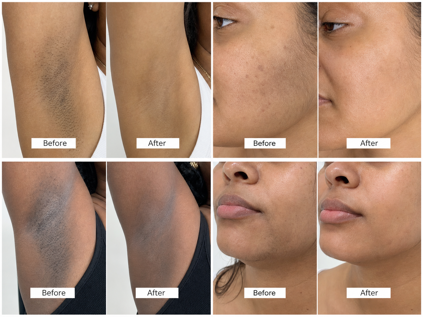 A collage of before and after photos showing skin improvements on underarms and facial areas.