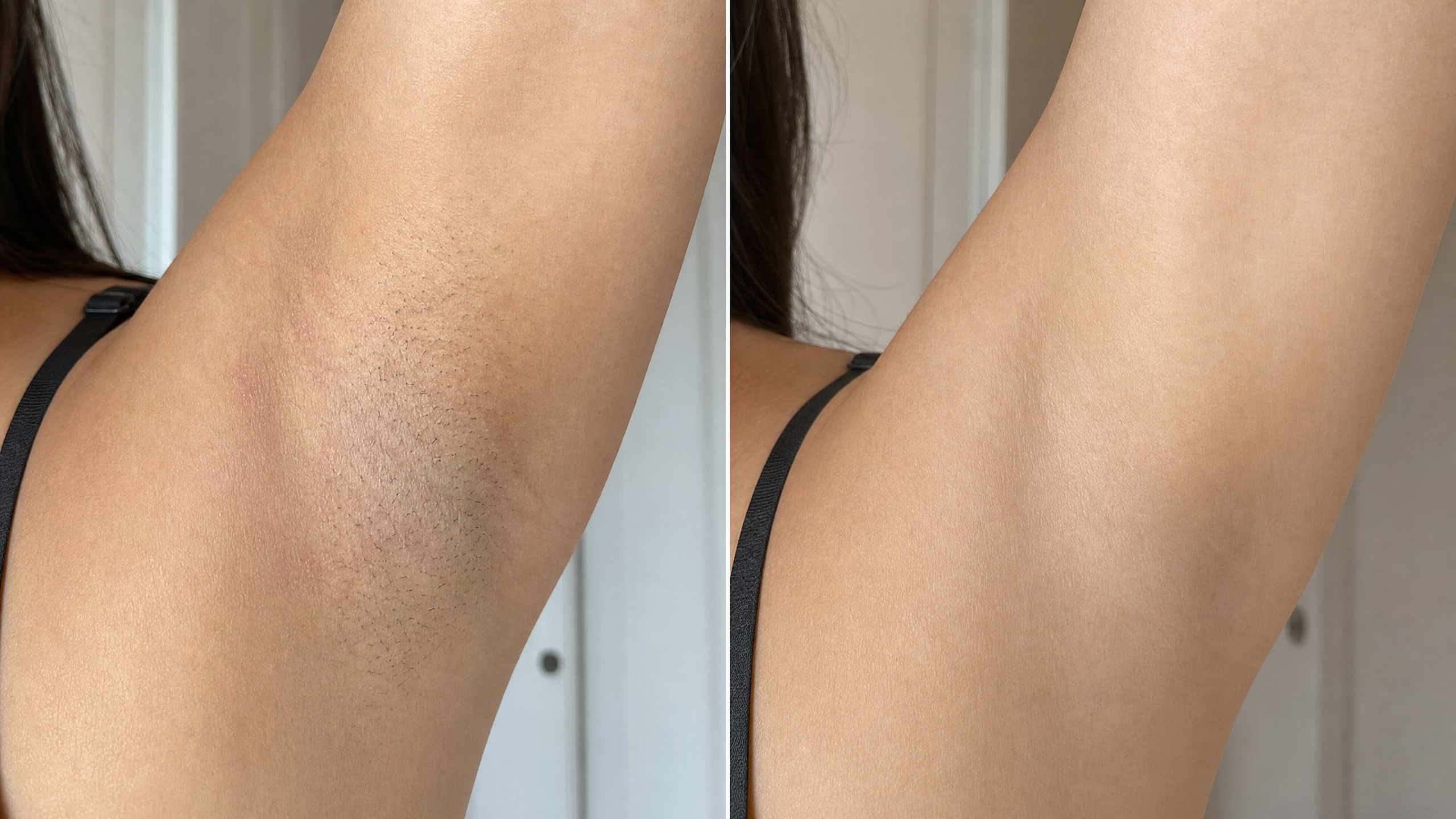 A before and after comparison of an underarm, showing it with hair stubble on the left and smooth on the right.