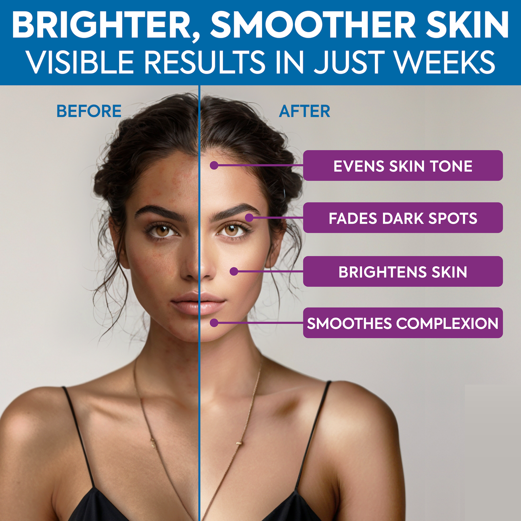 Split image of a woman's face showing skin improvement effects.