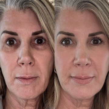 Side-by-side comparison of a person's face before and after makeup application.