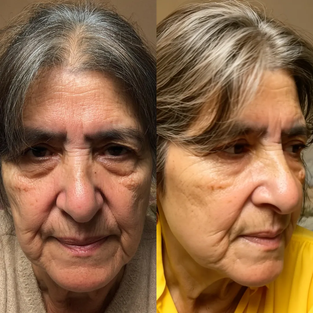 Close-up of an elderly woman with visible facial wrinkles.