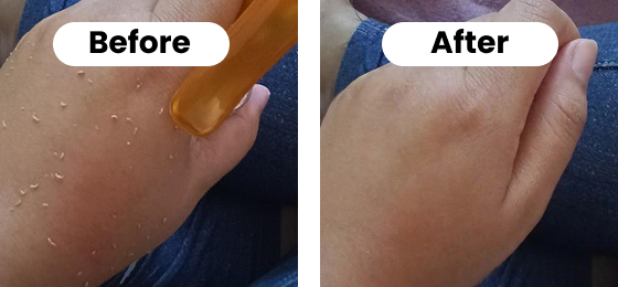 A before-and-after image showing flakes of skin being exfoliated from the back of a hand.