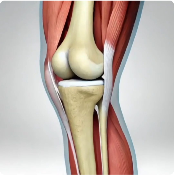 An anatomical illustration of a human knee joint, showing the bones, cartilage, and surrounding muscles.