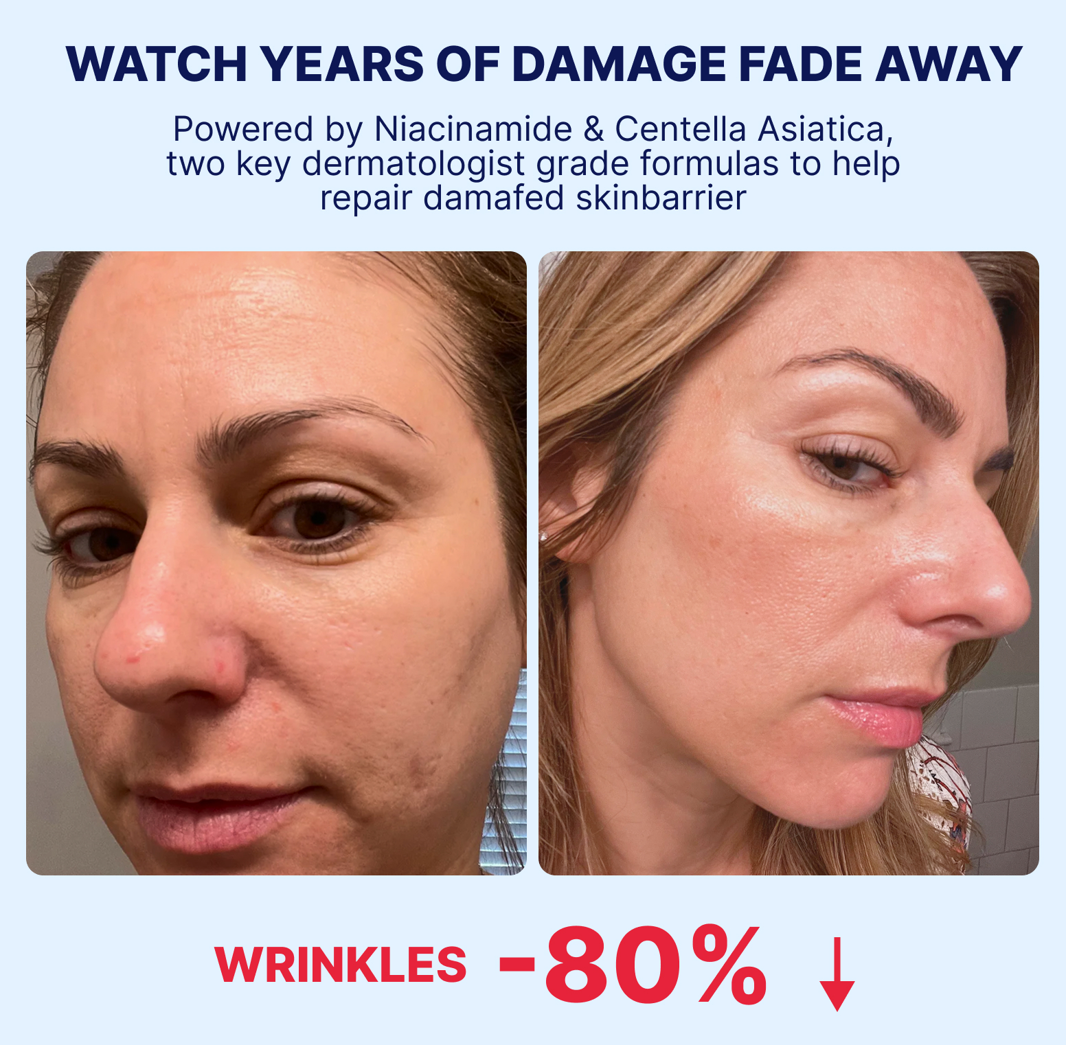 A before-and-after image showing a woman's face with a visible improvement in skin texture and fewer wrinkles.