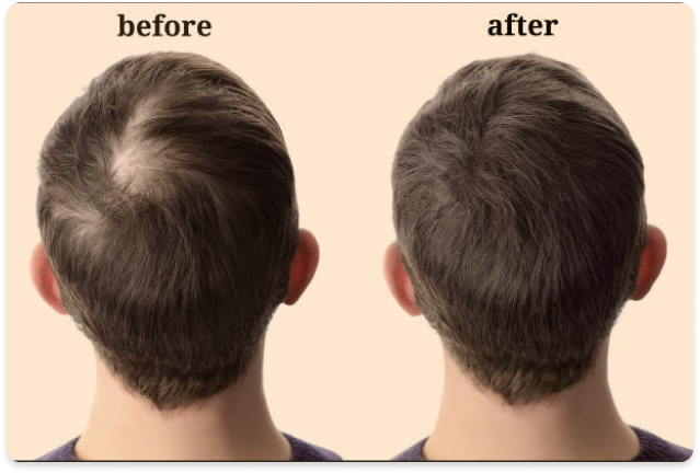 Side-by-side comparison of a man's hair before and after treatment.