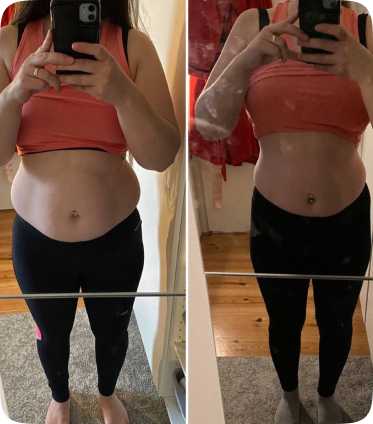 A side-by-side before-and-after comparison of a woman's midsection, showing a reduction in stomach size.