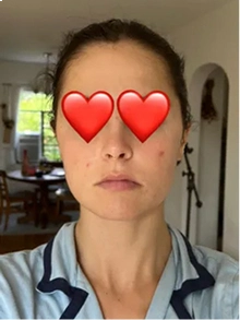A person's face with large red heart emojis covering their eyes, wearing a light blue collared shirt.