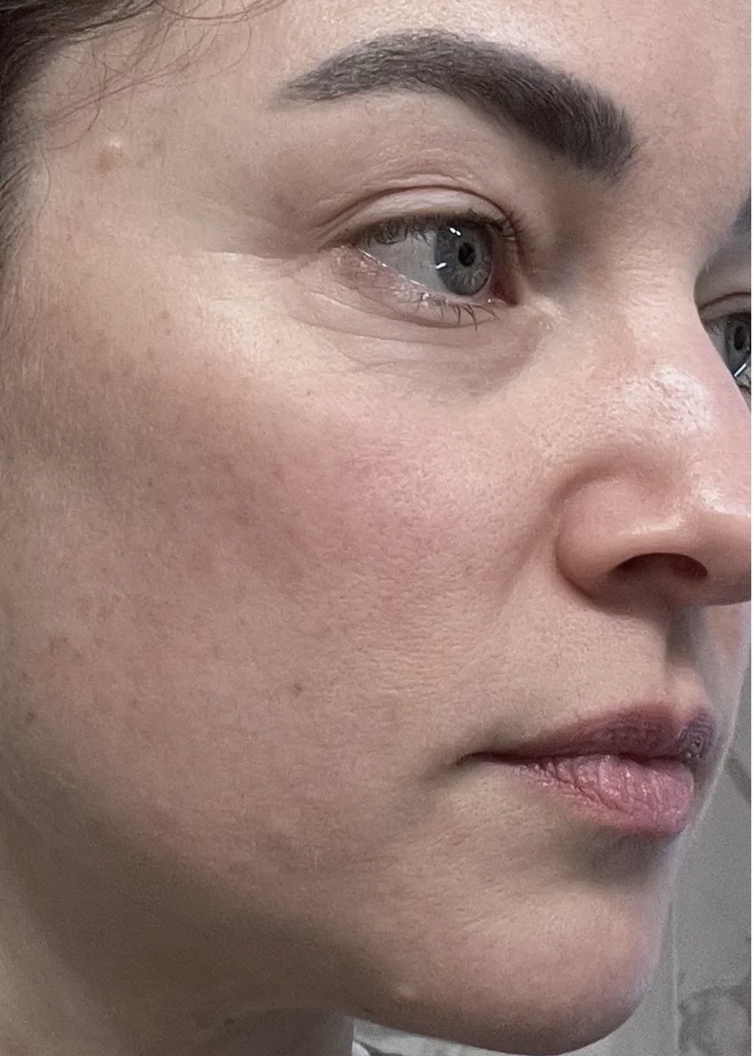 Close-up of a person's eye with faint under-eye discoloration.