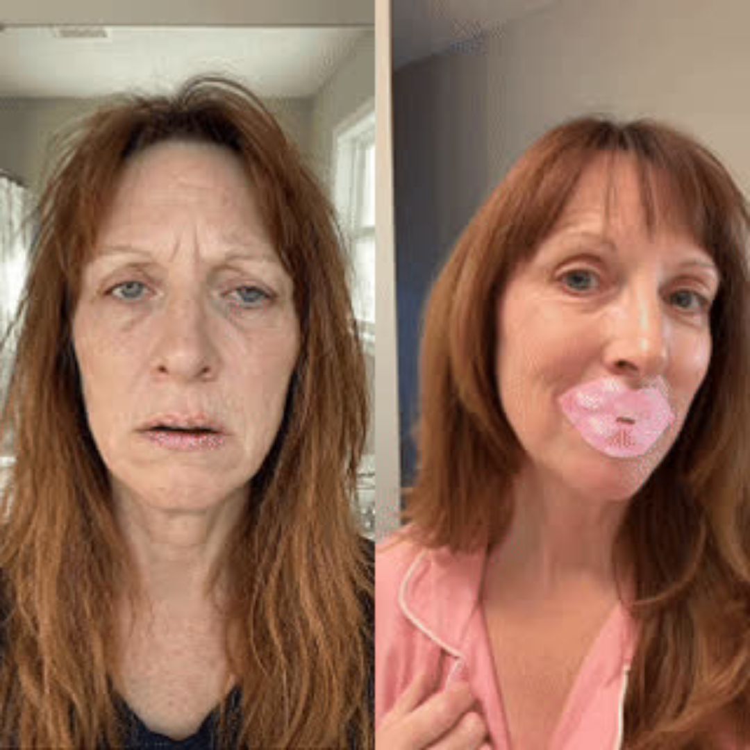 Two pink packages of Beauty Sleep mouth tape with images of a woman applying it.