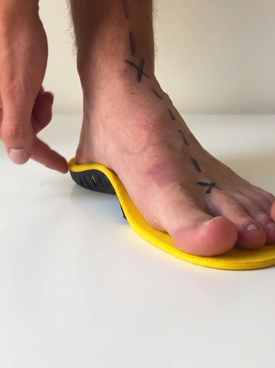 A close-up of a person's foot with black markings on it, resting on a yellow and black insole.
