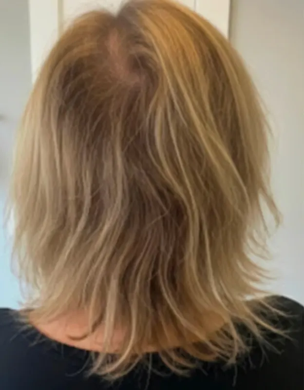 Back view of a person with medium-length blonde hair.