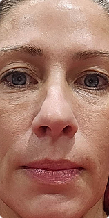 A close-up photograph of the middle portion of a woman's face, showing her eyes, nose, and mouth.