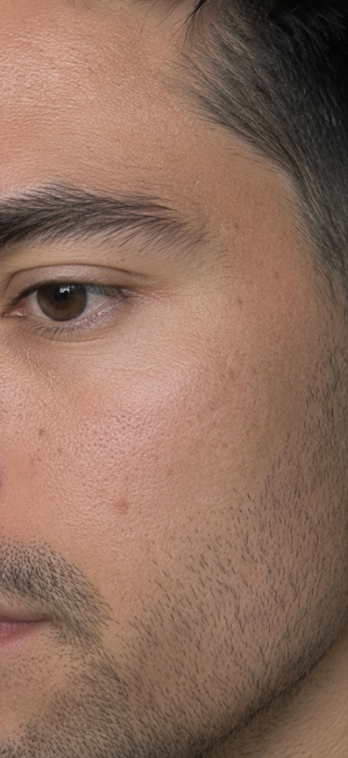 A close-up photo of the right side of a man's face, showing skin texture and his eye.