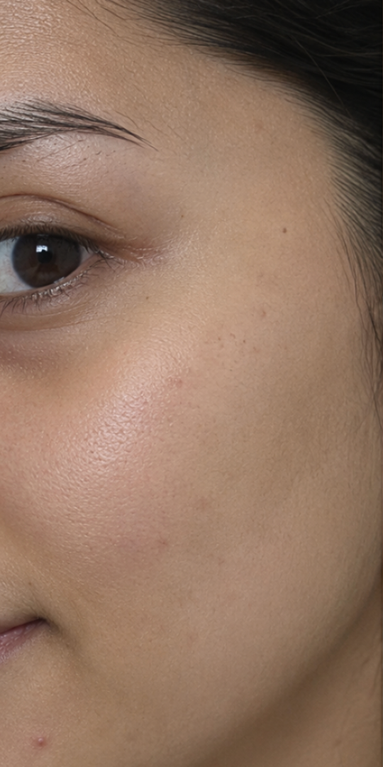 A close-up of the right side of a person's face, showing their eye, eyebrow, and cheek.