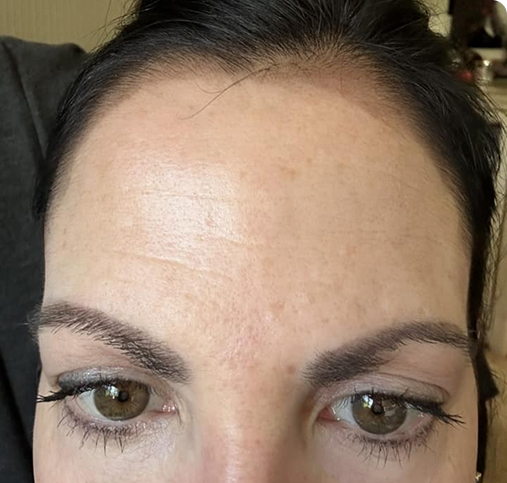 Close-up of a person's forehead and eyes with dark hair.