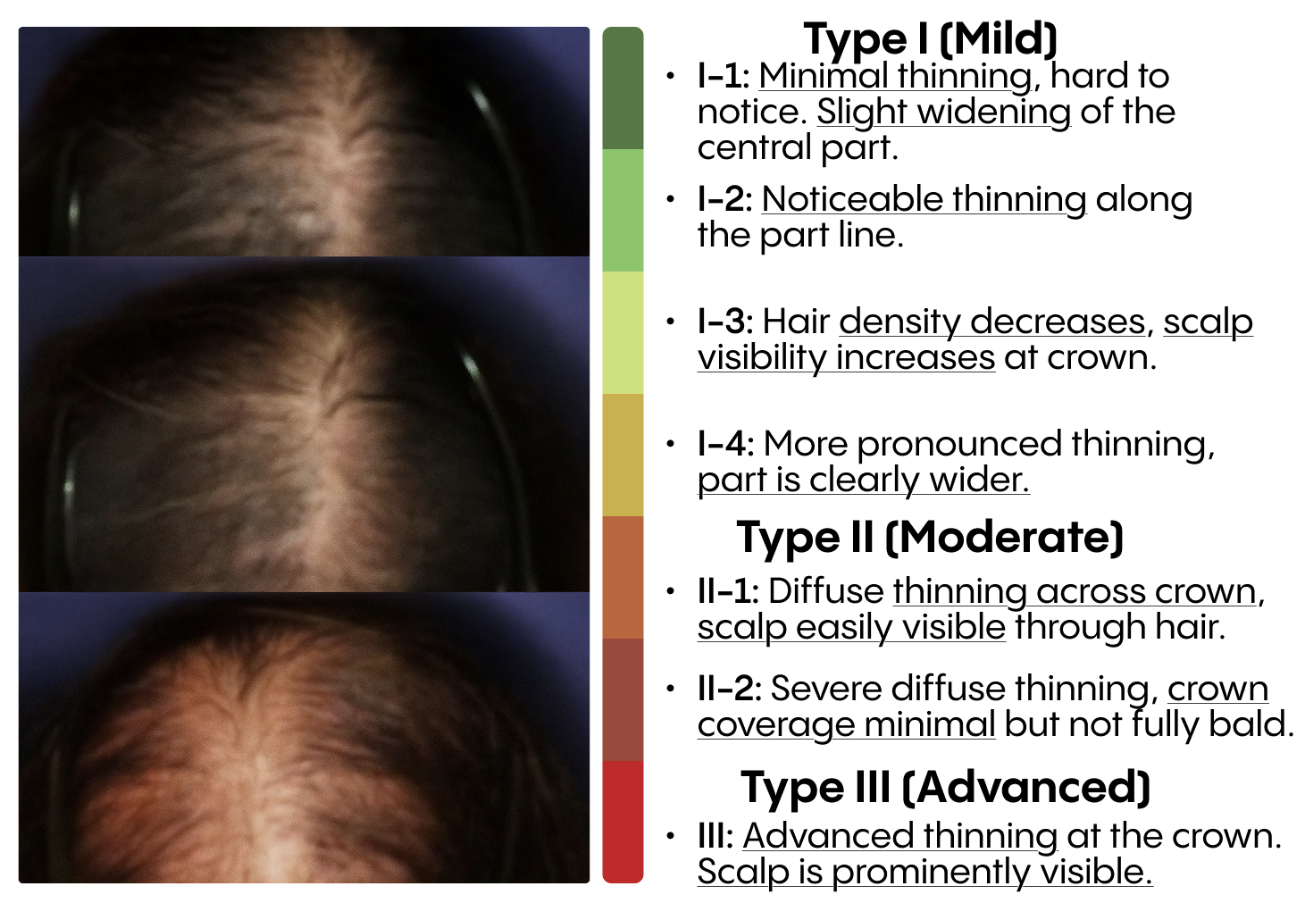 Comparison of scalp images with color swatches on the right.