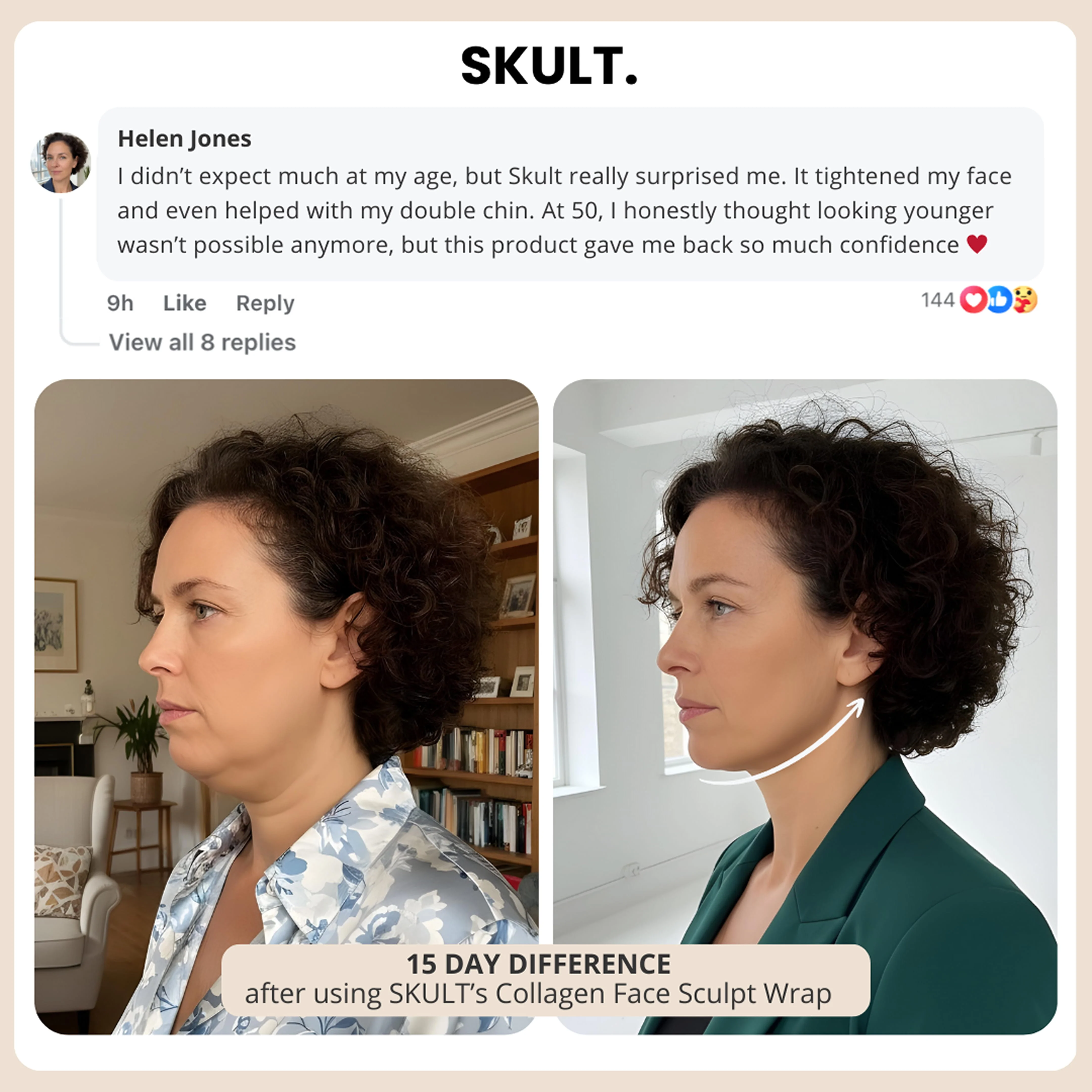 Before and after photos showing a woman's facial profile, with a customer testimonial for a beauty product.