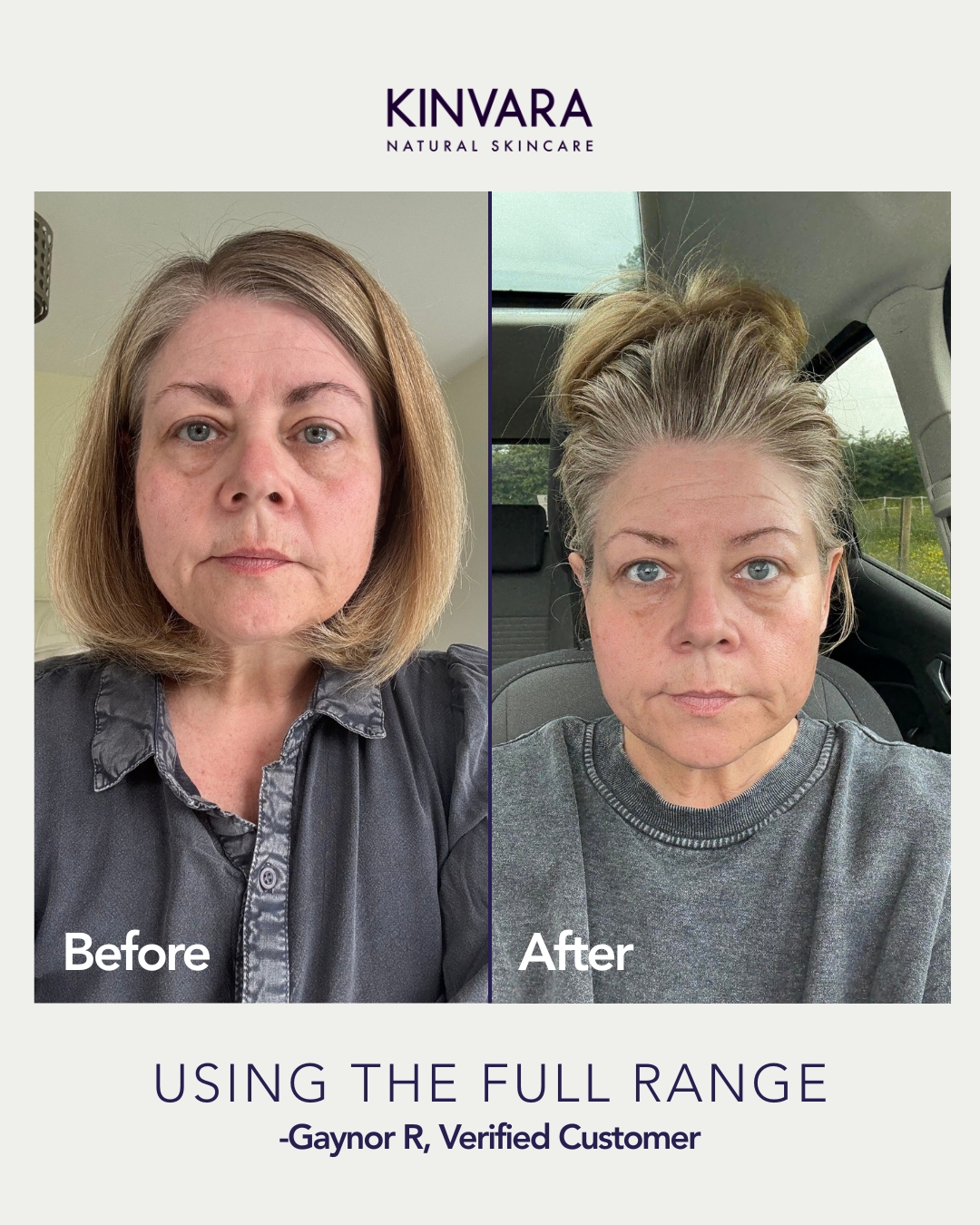 Side-by-side comparison of a woman's face before and after using skincare products.
