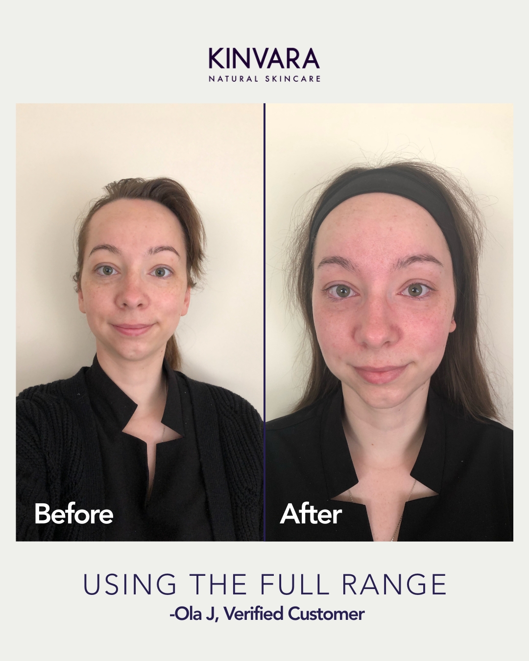 Before and after skincare comparison of a woman's face.