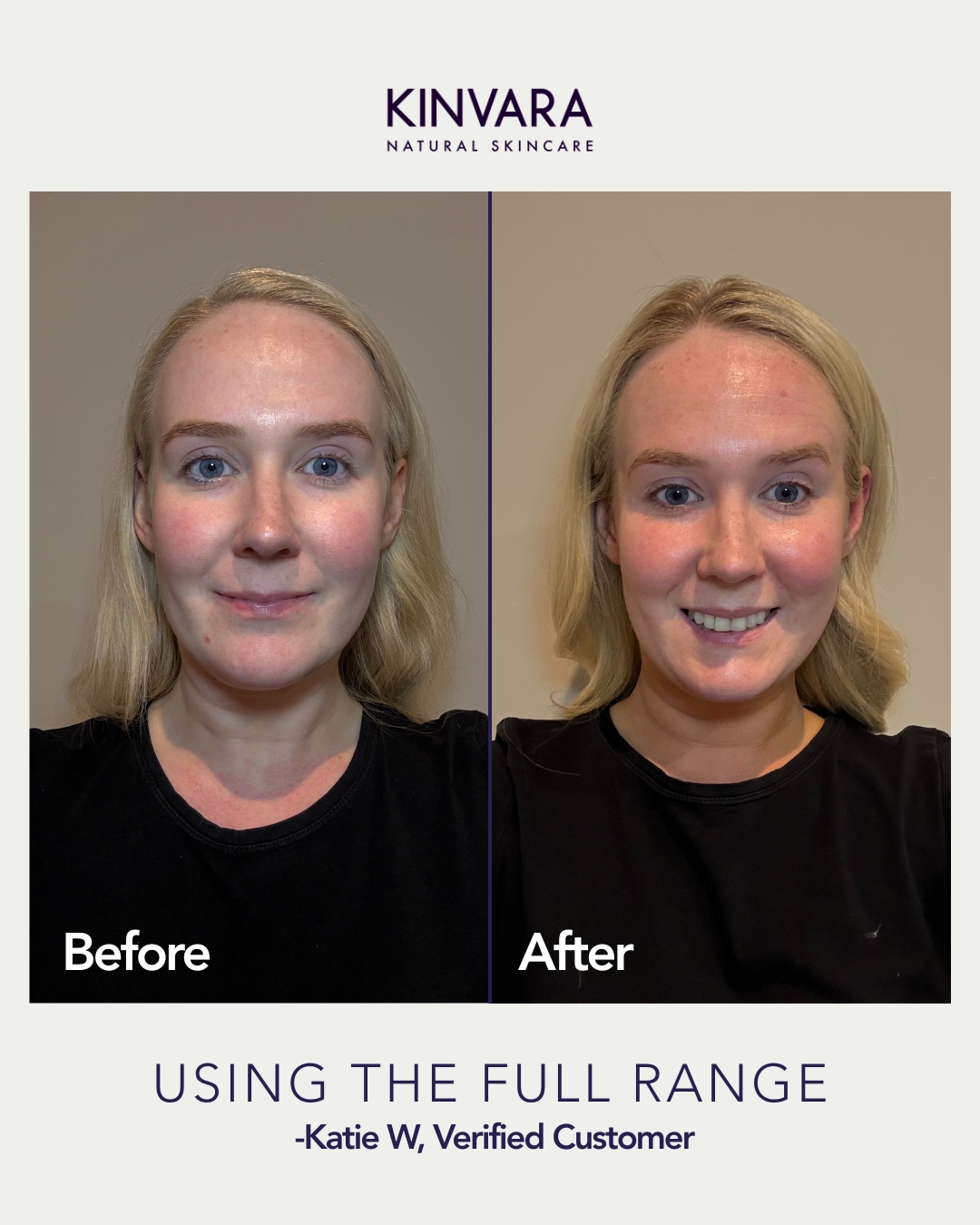 Side-by-side before and after photos of a woman using skincare products.