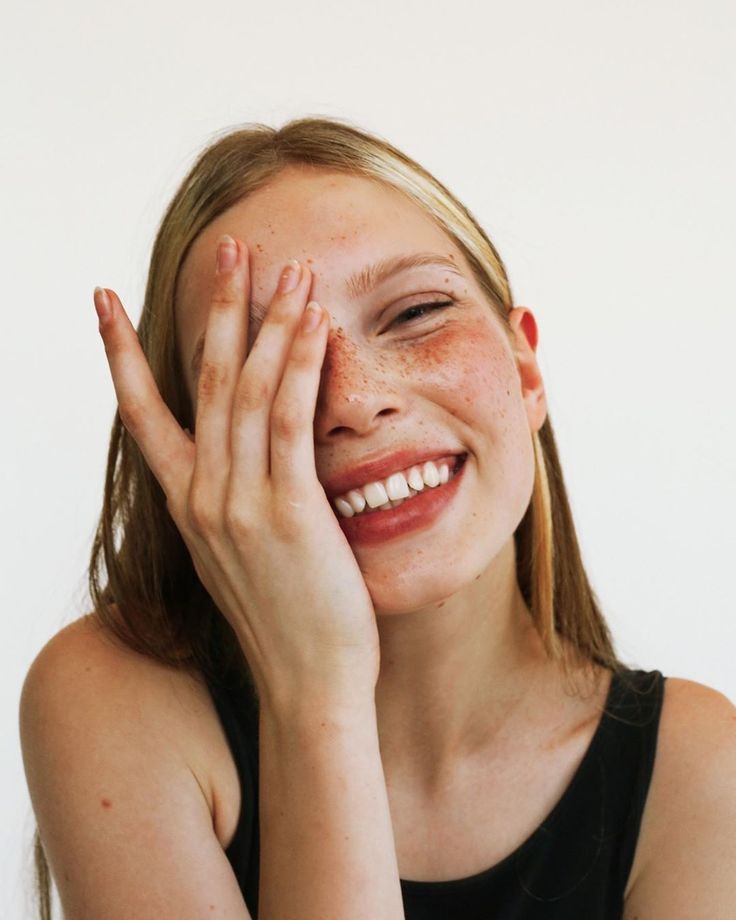 Person smiling, covering one eye with their hand.