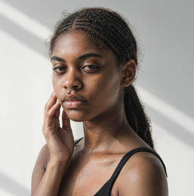 A person with their hair pulled back rests their head on their hand, looking at the camera.