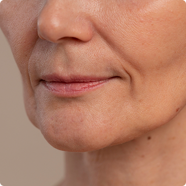 A close-up of the lower part of a woman's face, showing her mouth, chin, and smile lines.