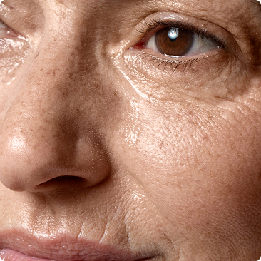 A close-up of a person's face, focusing on the skin texture, wrinkles, and eye.