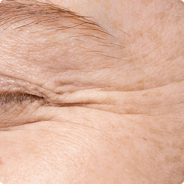 A close-up macro shot of the wrinkles and fine lines around a person's closed eye.