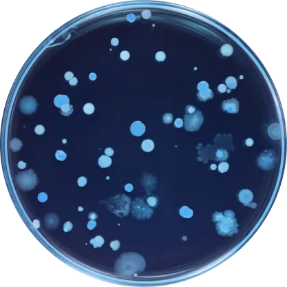 Petri dish with various bacterial colonies on a dark blue medium.