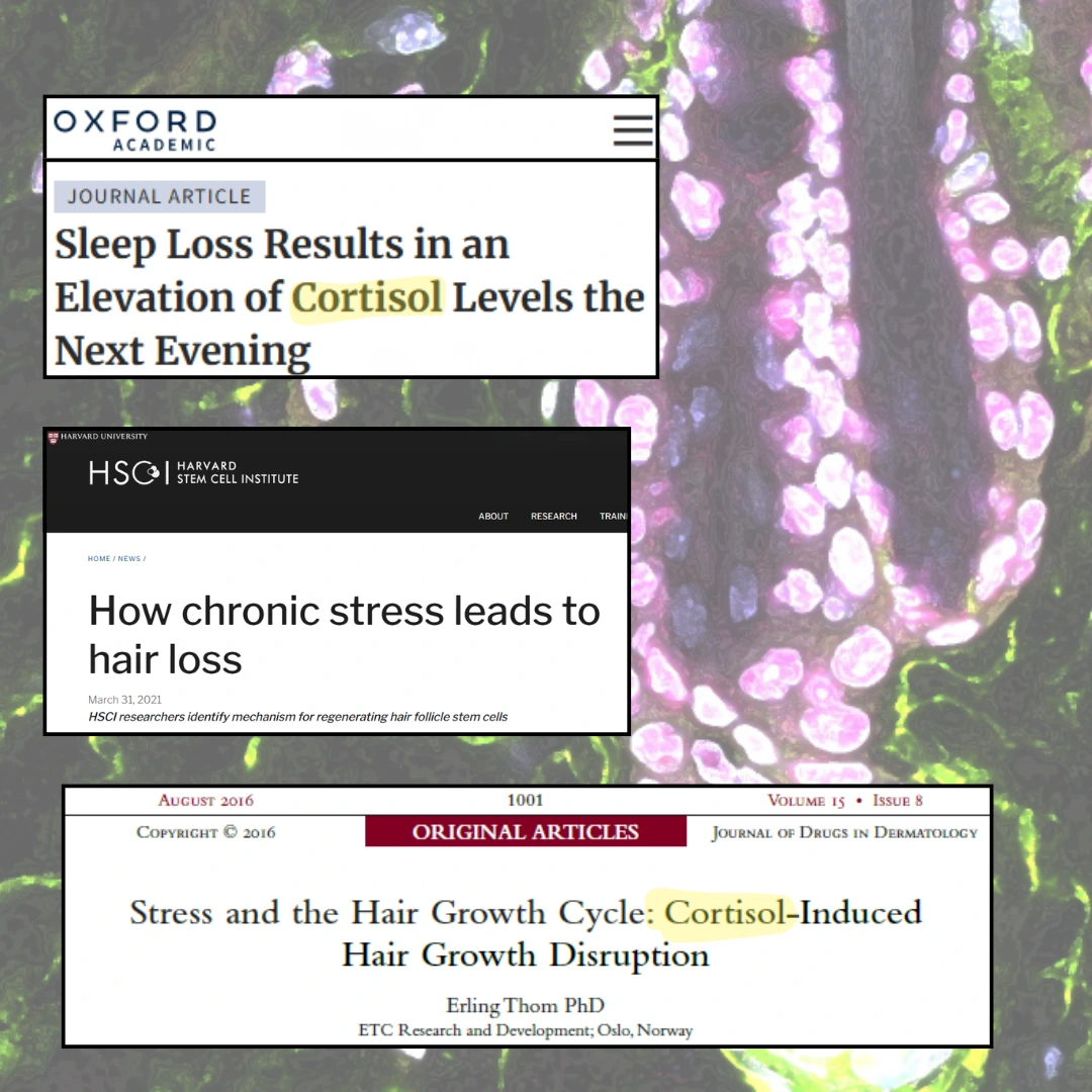 Collage of articles about cortisol, stress, and hair loss.