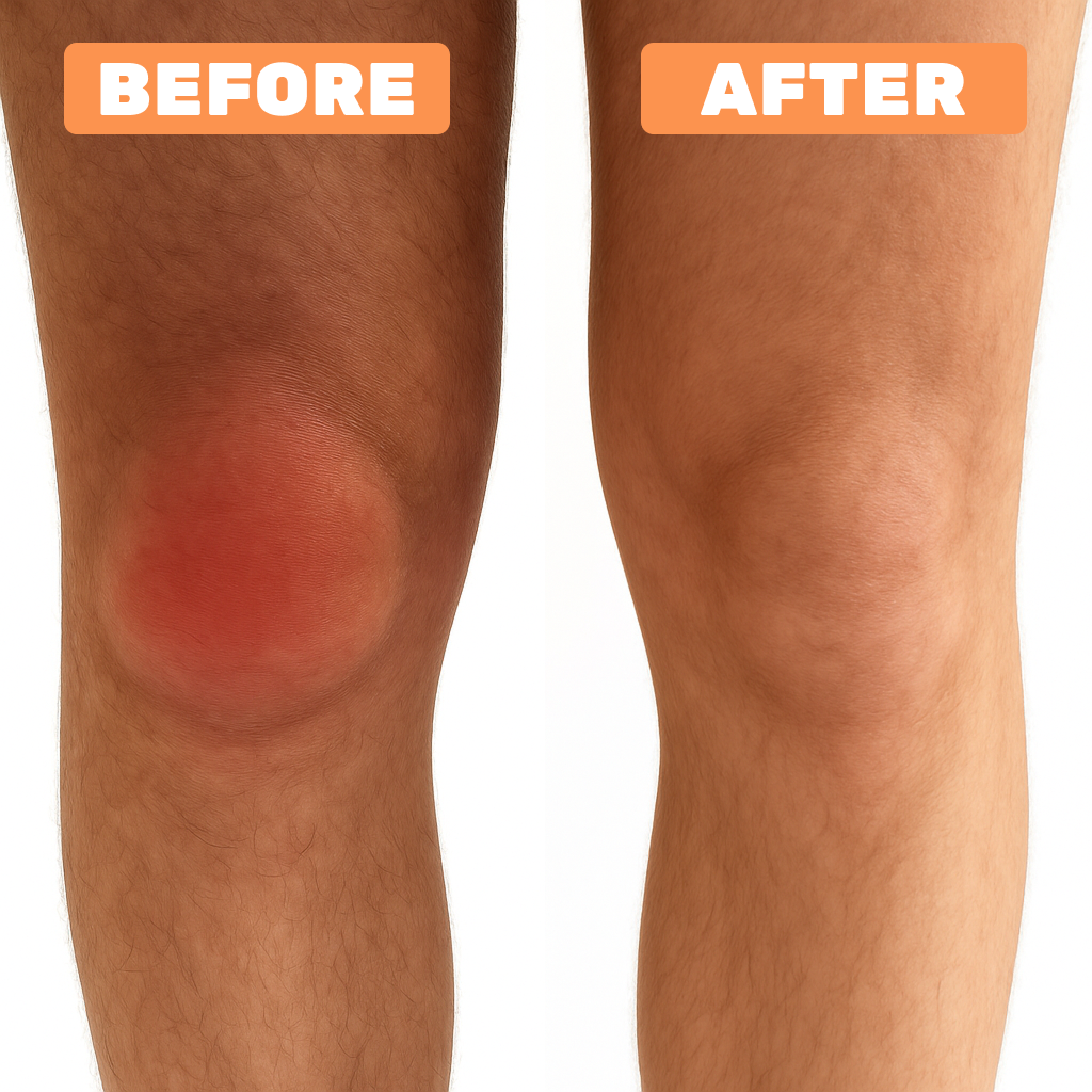 Comparison of a red, swollen knee and a normal knee labeled 'Before' and 'After.'
