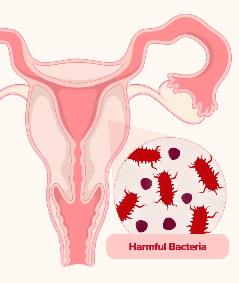 A three-stage infographic in German showing the progression from a healthy vaginal flora to bacterial vaginosis due to pH changes.