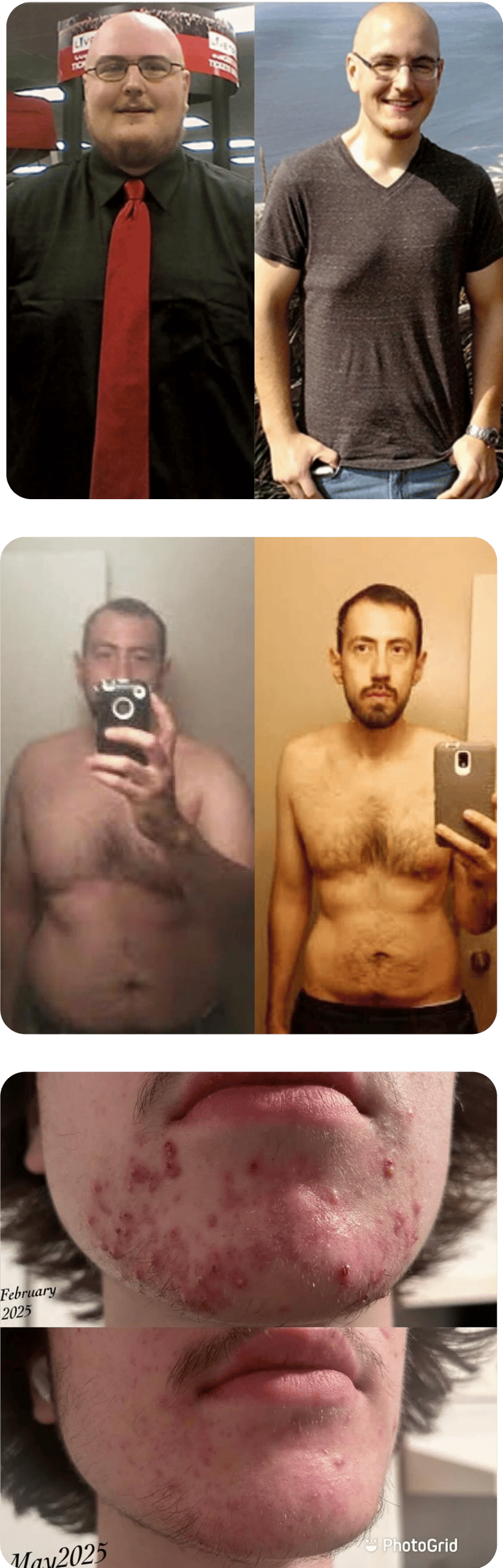 Before and after transformation