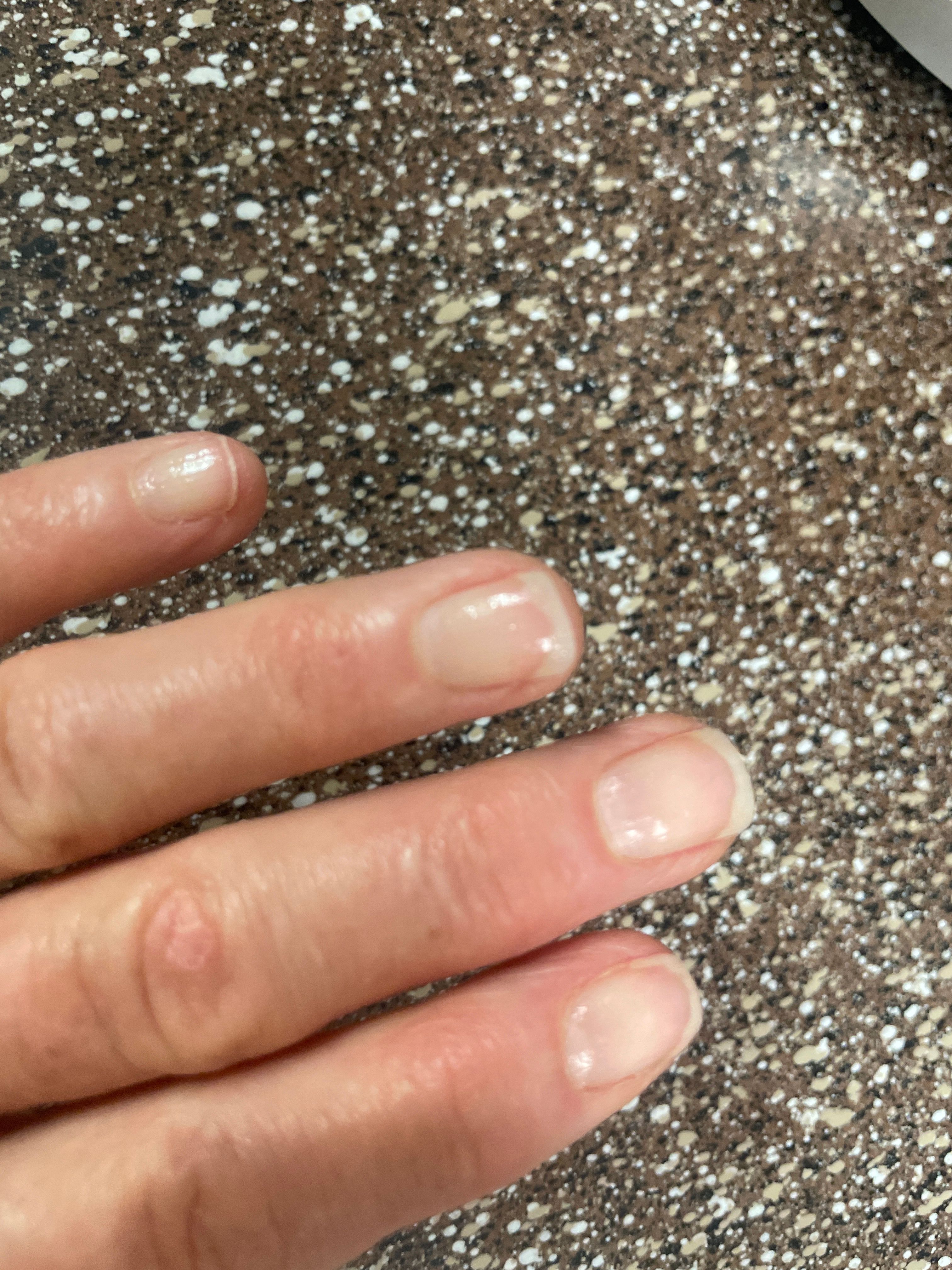 A close-up of a person's fingers with shiny, natural-looking nails against a speckled brown countertop.