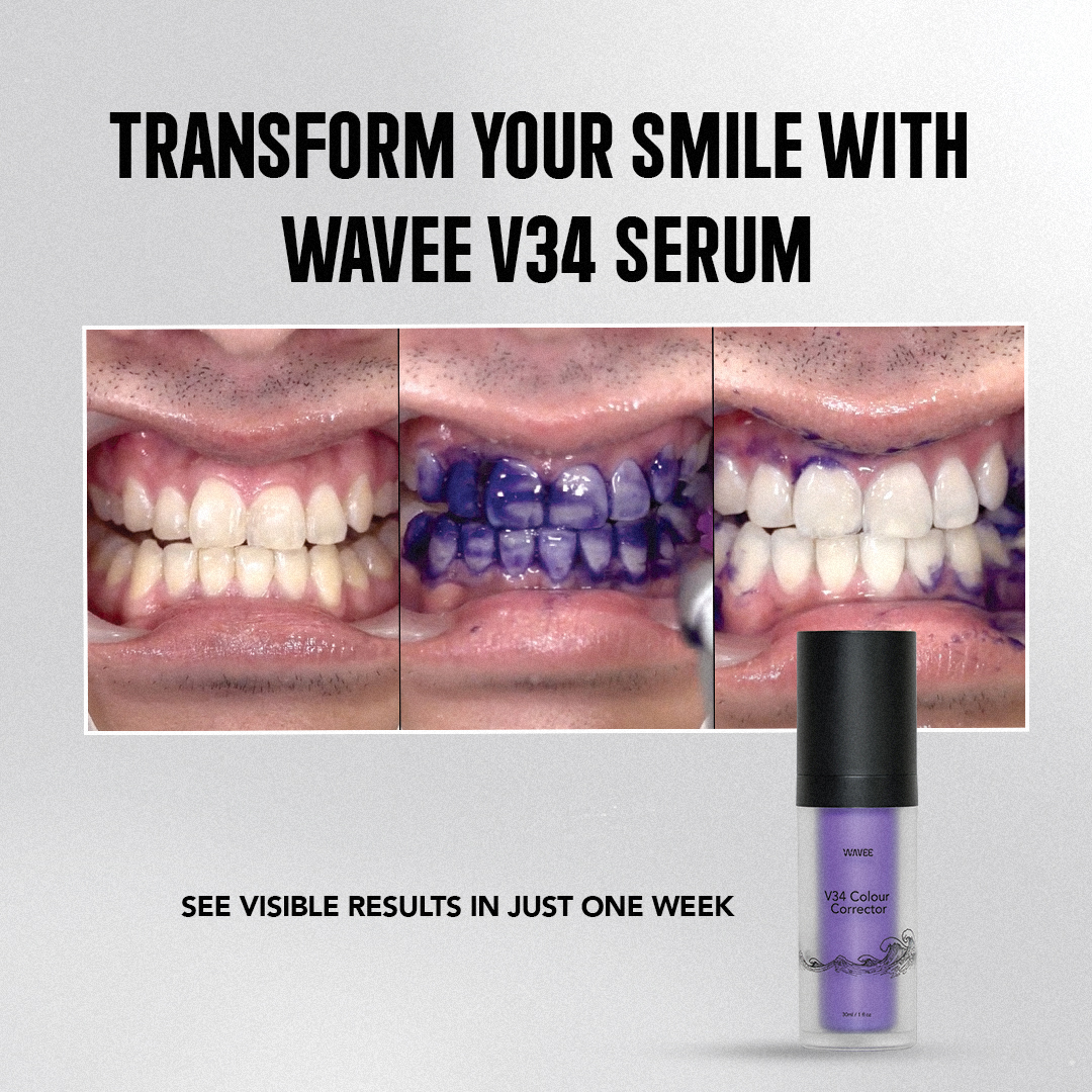 Teeth whitening process using V34 serum, featuring before-and-after images and product bottle.