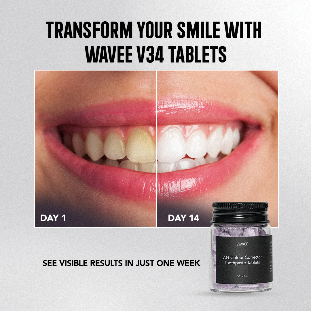 Comparison of teeth whitening results using Wavee V34 tablets over 14 days.