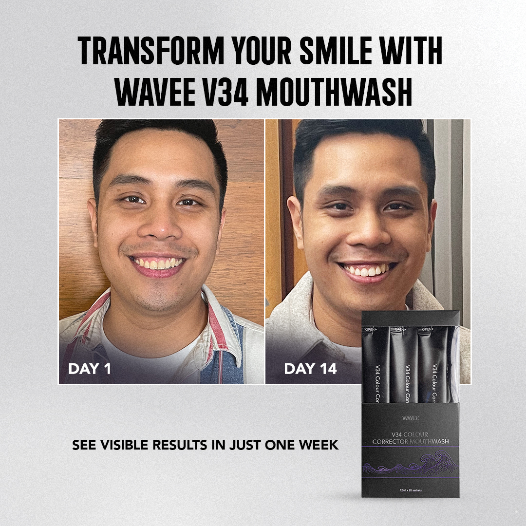 Before and after photos of a man using Wavee V34 Mouthwash for teeth color correction.