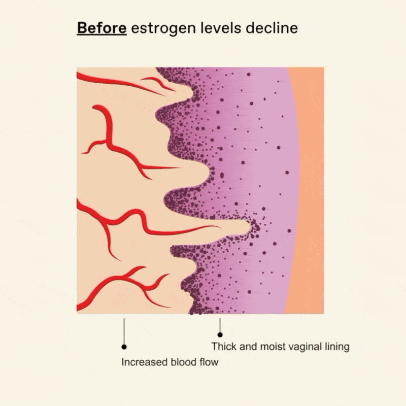 Animated diagram showing changes in vaginal lining and blood flow before and after estrogen decline.