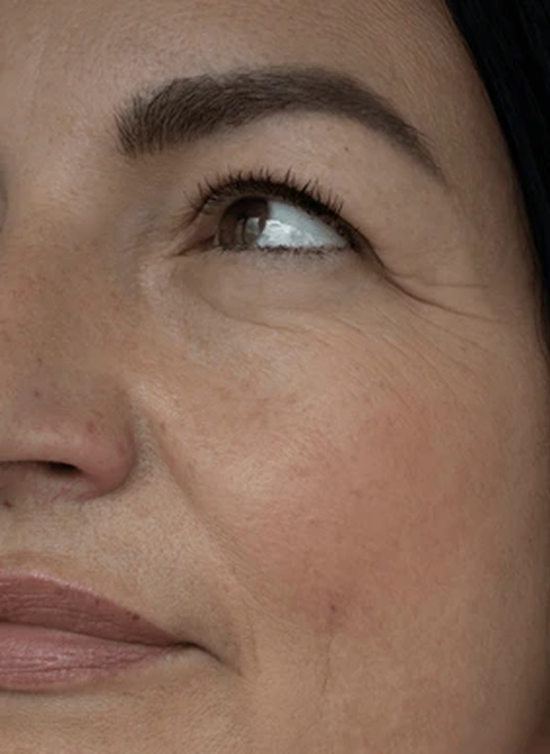 A close-up of a woman's face, focusing on the fine lines and wrinkles around her eye.