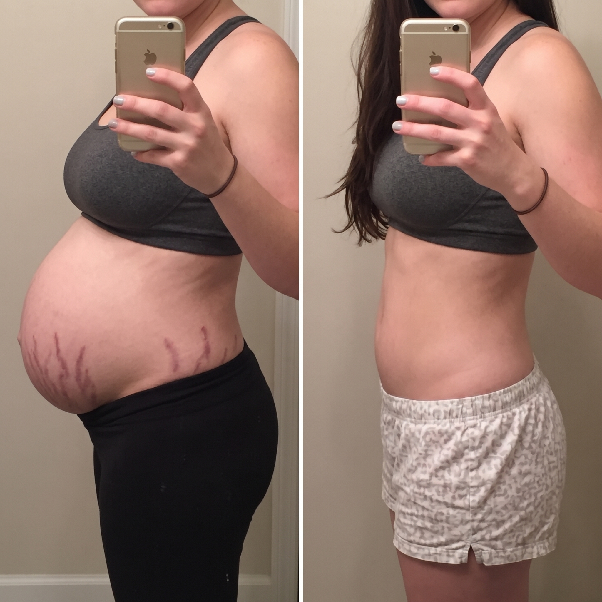 A side-by-side comparison of a woman's pregnant belly on the left and her flatter stomach on the right.