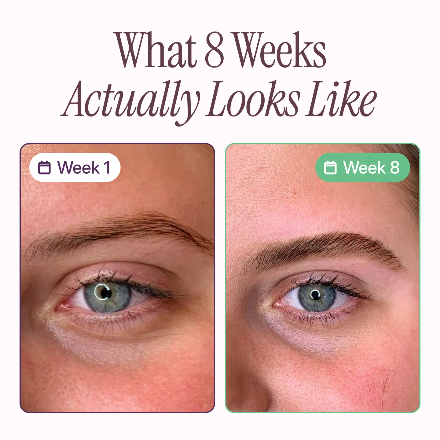 Before and after photos of an eye area, showing eyebrow growth and thickening over eight weeks.