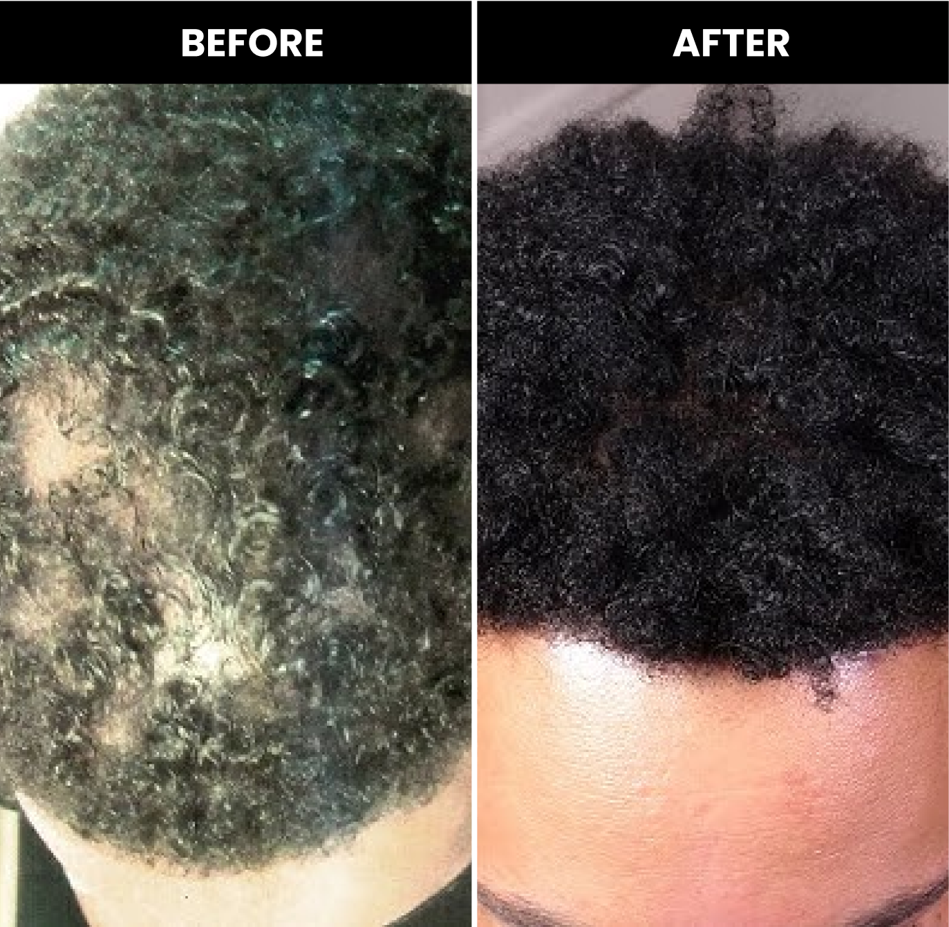 Side-by-side comparison of hair before and after treatment.