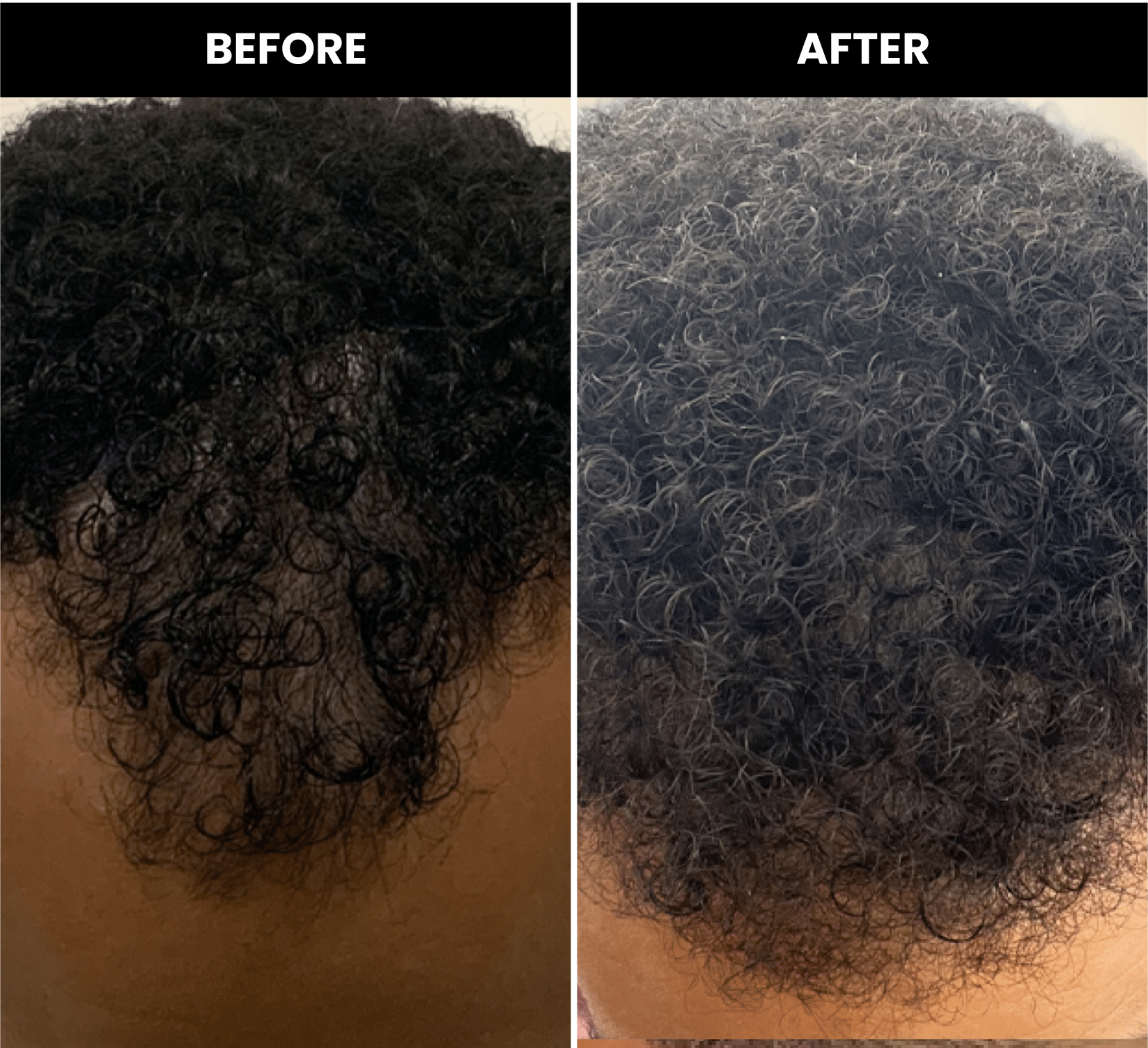 Side-by-side comparison of hair before and after treatment, showing increased fullness.