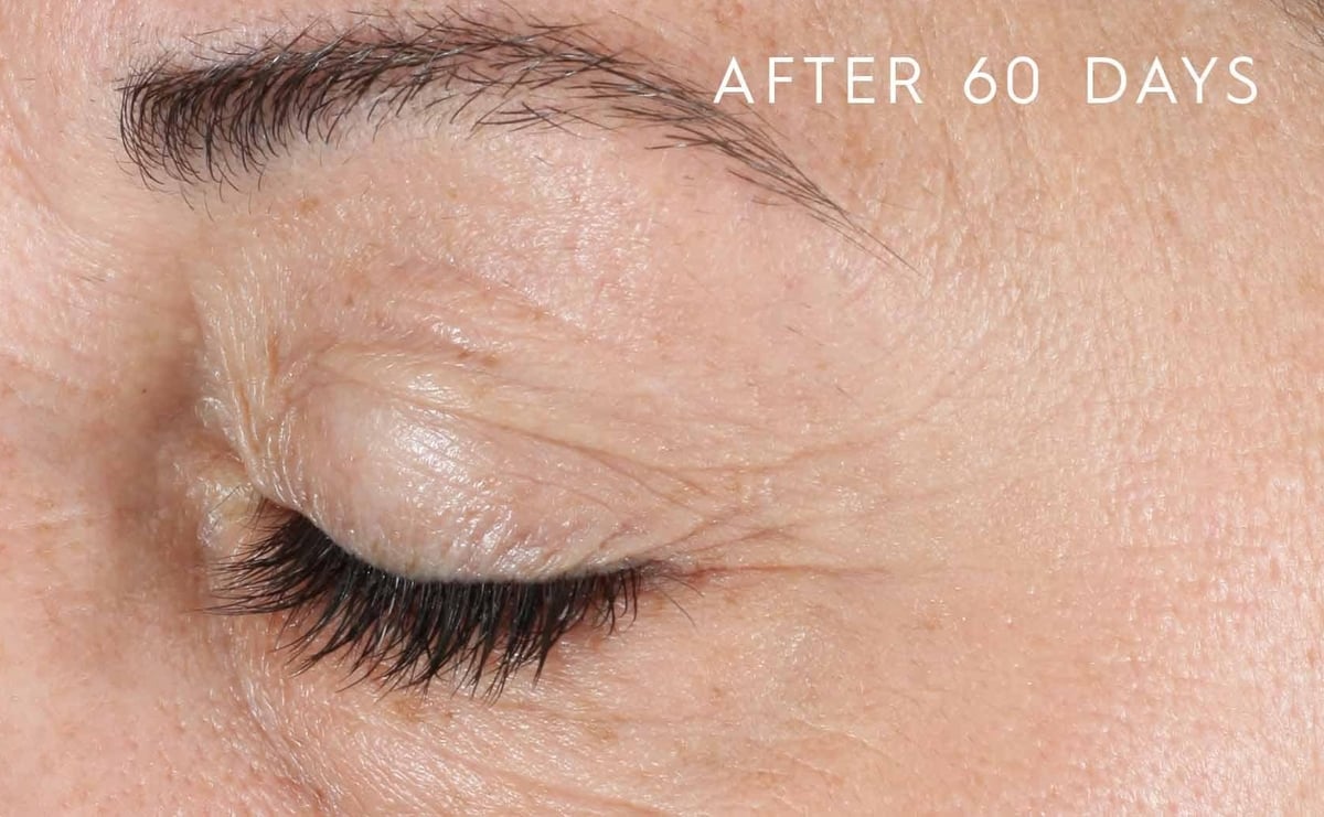 After 60 days of YOUTHFUL Quattro Peptide Serum