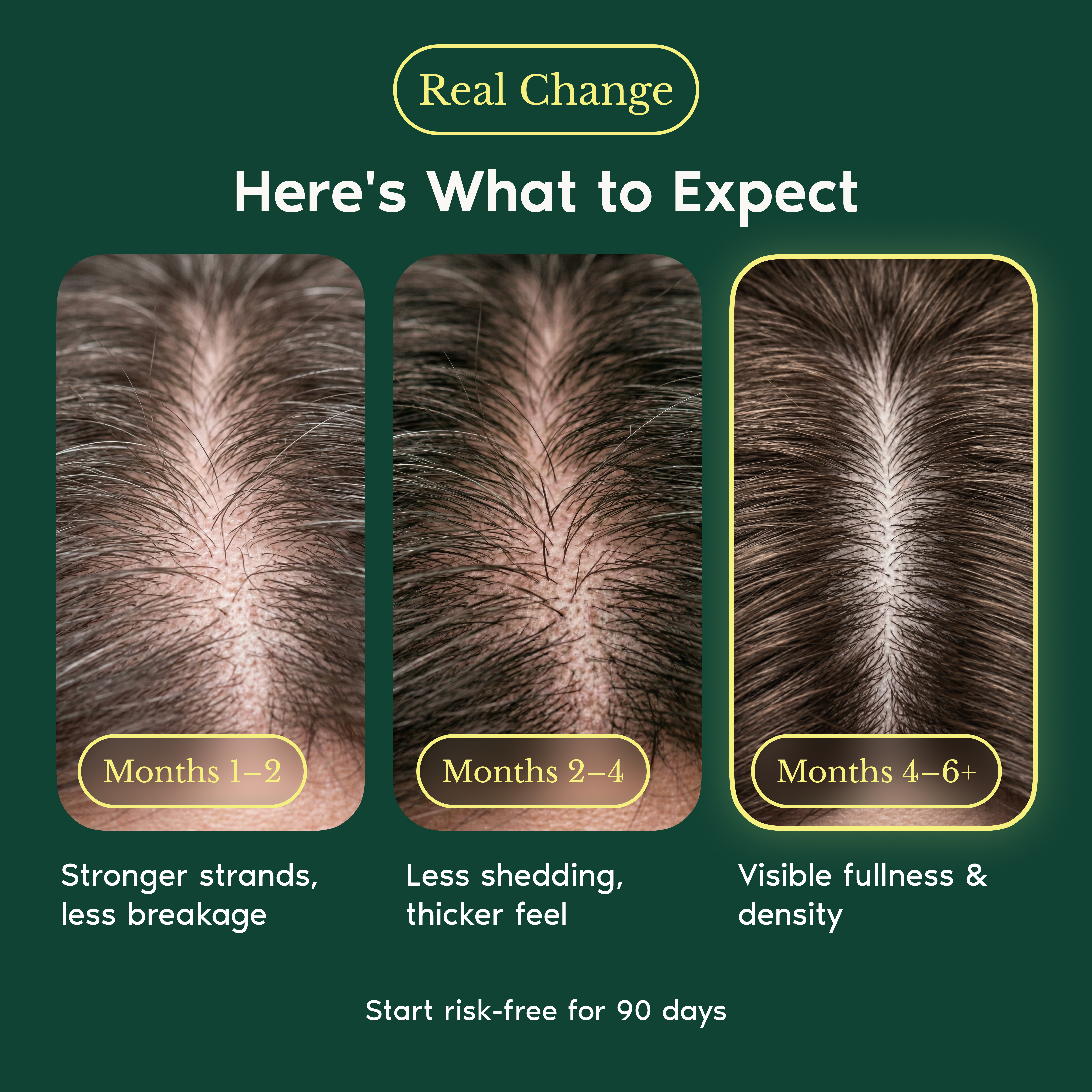 Three close-up images showing a hair part becoming denser and fuller over a six-plus month timeline.