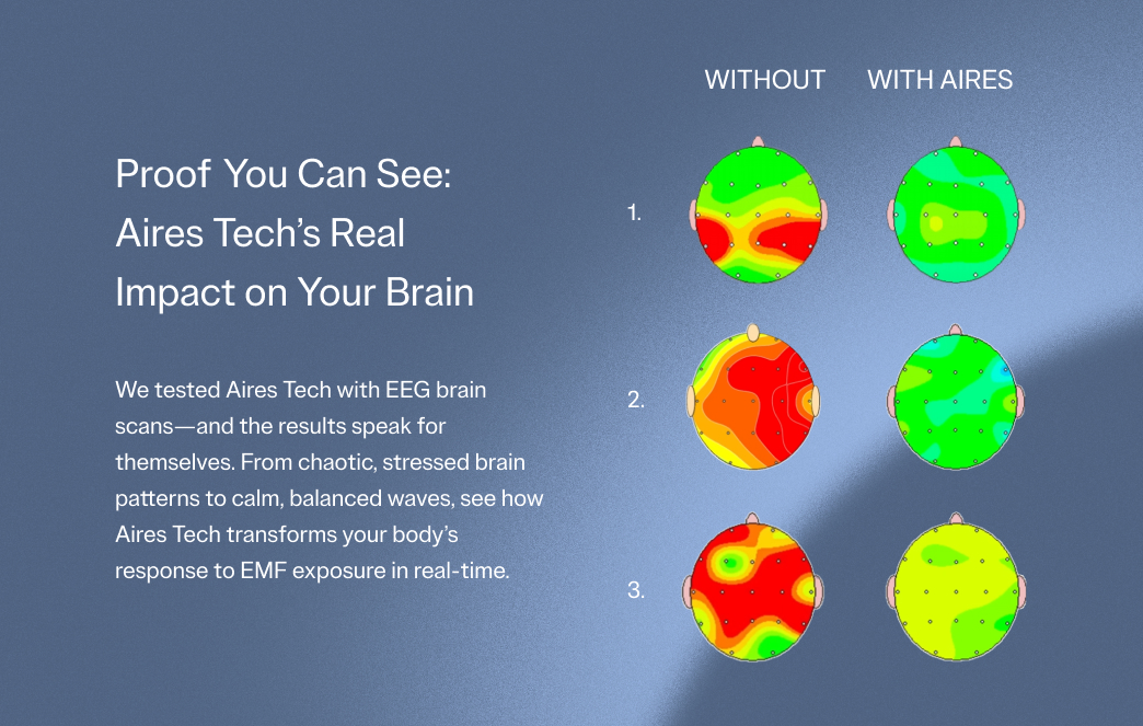 Comparison of EEG brain scans with and without Aires Tech, showing different color patterns.