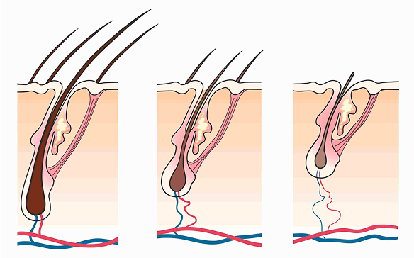 Illustration of hair follicle anatomy in three stages with color-coded veins and arteries.