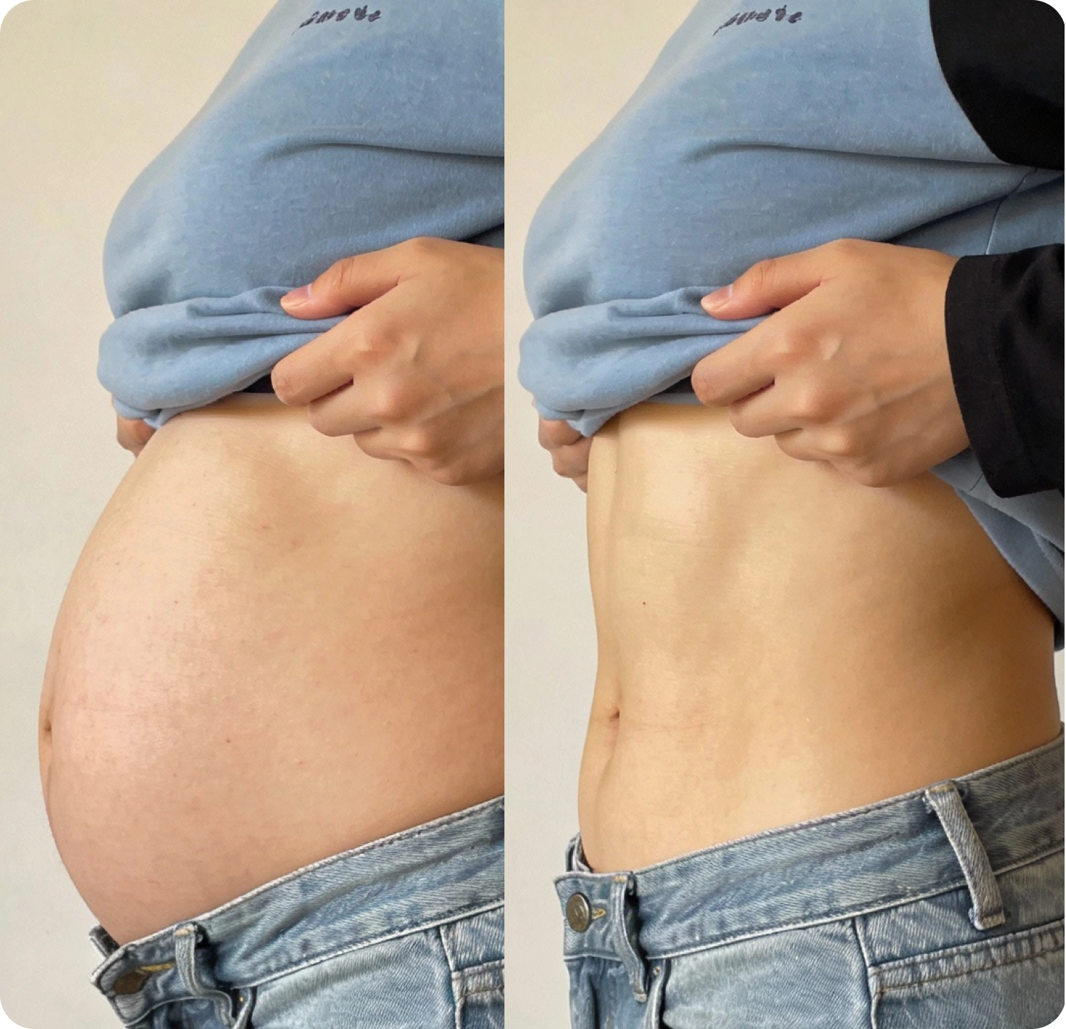 A side-by-side comparison of a person's torso, showing a bloated stomach on the left and a flat one on the right.