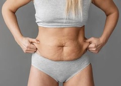 A woman in grey underwear pinches the loose skin and fat on her abdomen.